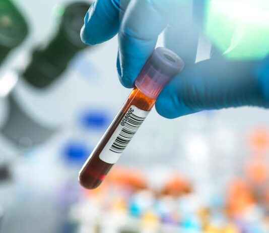 Breakthrough in medicine: Researchers transform blood types A and B into universal blood